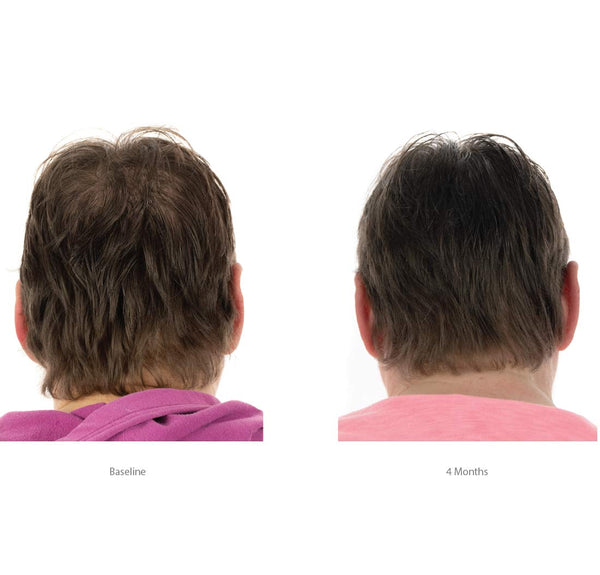 FOLIGAIN Triple Action Conditioner For Thinning Hair For Women with 2% Trioxidil - FOLIGAIN JAPAN
